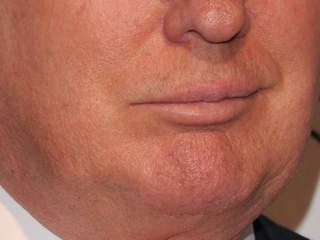 Illustration for article titled A Visual History of Donald Trump's Mouth
